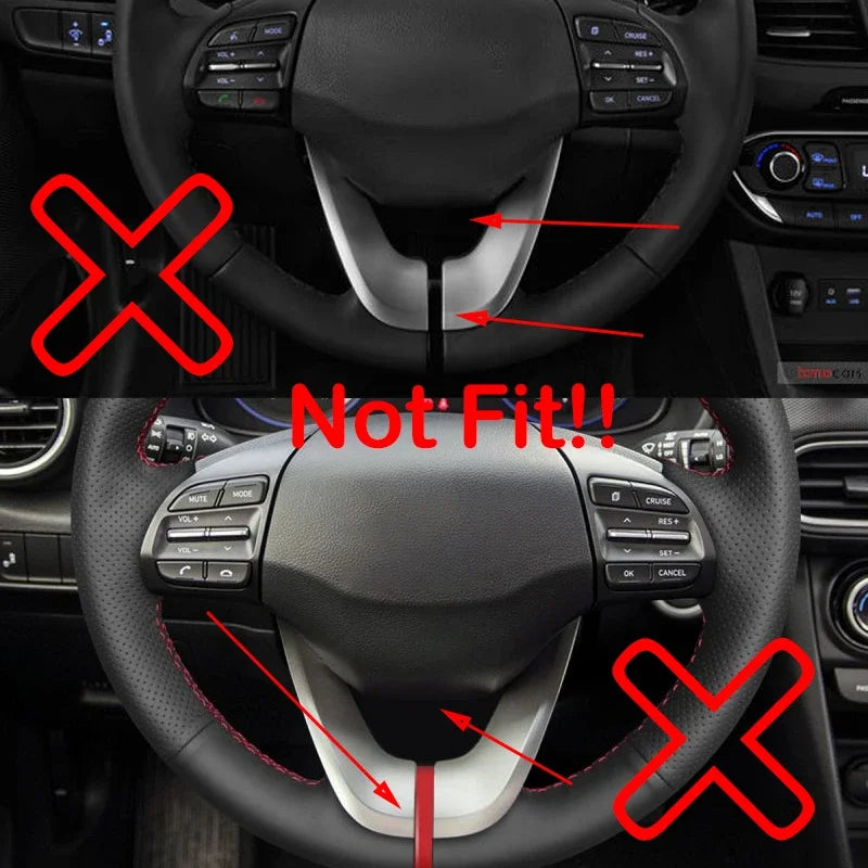 For Hyundai Elantra 2017-2020 IONIQ Veloster Carbon Fiber St